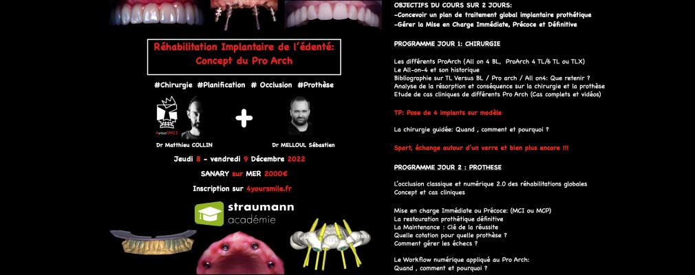 Centre implantologie dentaire rehabilitation implantaire edente