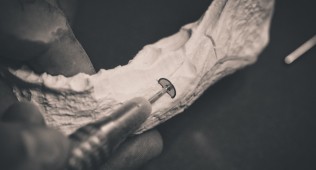 Dr Collin Centre chirurgie buccale implant