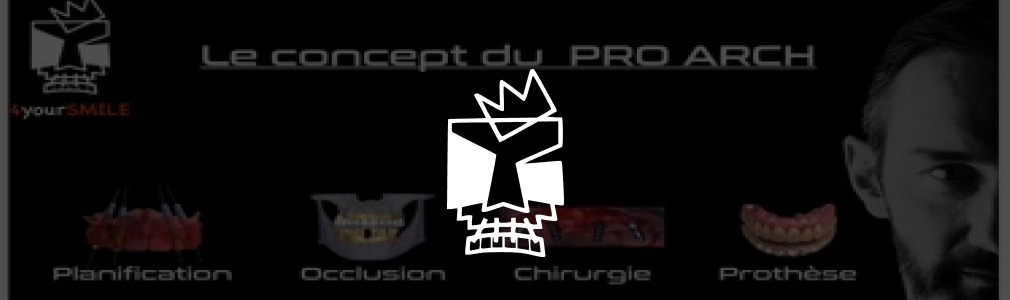 Dr Collin occlussion pro arch NICE